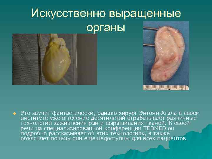 Искусственно выращенные органы u Это звучит фантастически, однако хирург Энтони Атала в своем институте
