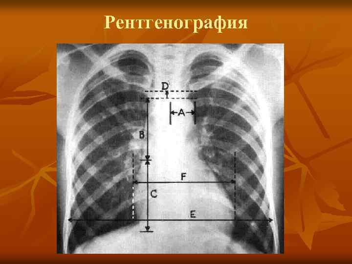 Рентгенография 