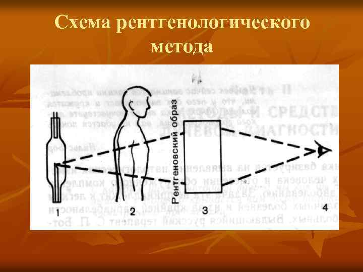 Схема рентгенологического метода 