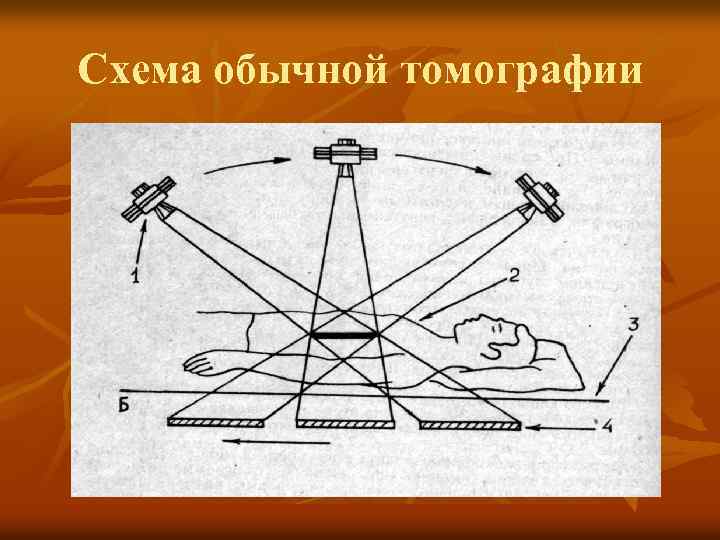 Схема обычной томографии 