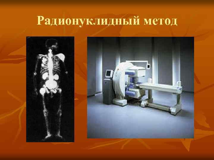 Радионуклидный метод 