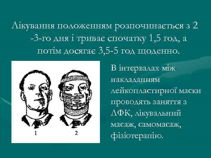 Лікування положенням розпочинається з 2 -3 -го дня і триває спочатку 1, 5 год,