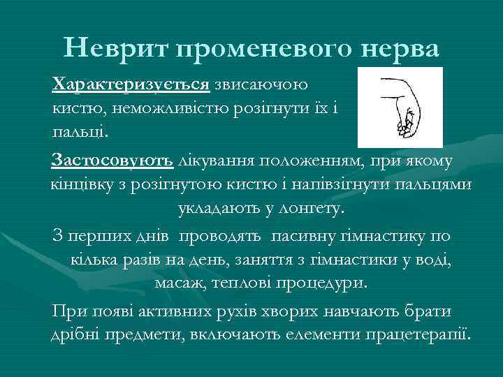 Неврит променевого нерва Характеризується звисаючою кистю, неможливістю розігнути їх і пальці. Застосовують лікування положенням,