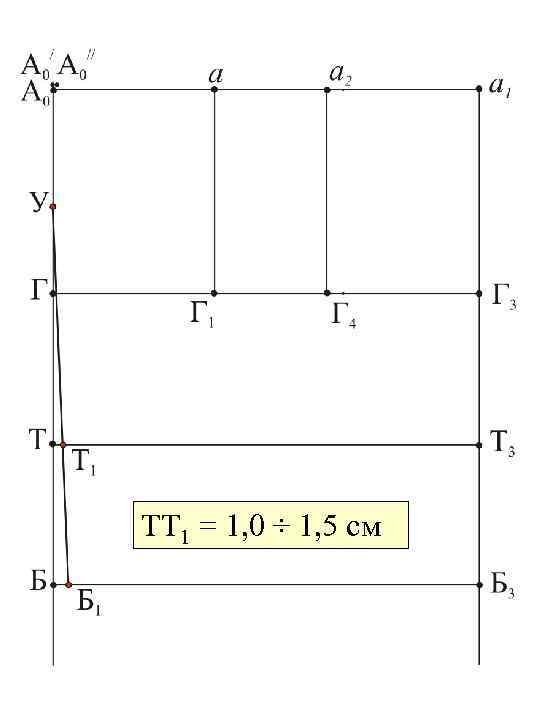 ТТ 1 = 1, 0 ÷ 1, 5 см 