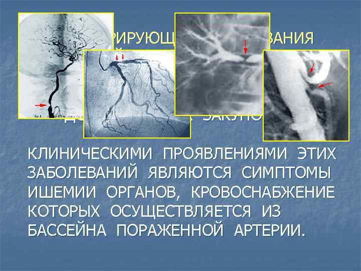 ОБЛИТЕРИРУЮЩИЕ ЗАБОЛЕВАНИЯ АРТЕРИЙ - ЭТО ЗАБОЛЕВАНИЯ, СОПРОВОЖДАЮЩИЕСЯ ПОСТЕПЕННЫМ СУЖЕНИЕМ ПРОСВЕТА АРТЕРИЙ ВПЛОТЬ ДО ПОЛНОЙ
