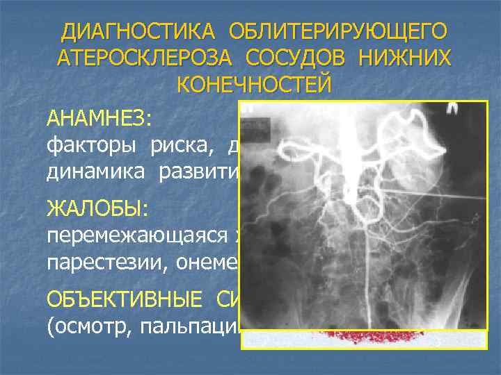 ДИАГНОСТИКА ОБЛИТЕРИРУЮЩЕГО АТЕРОСКЛЕРОЗА СОСУДОВ НИЖНИХ КОНЕЧНОСТЕЙ АНАМНЕЗ: факторы риска, длительность и динамика развития заболевания.
