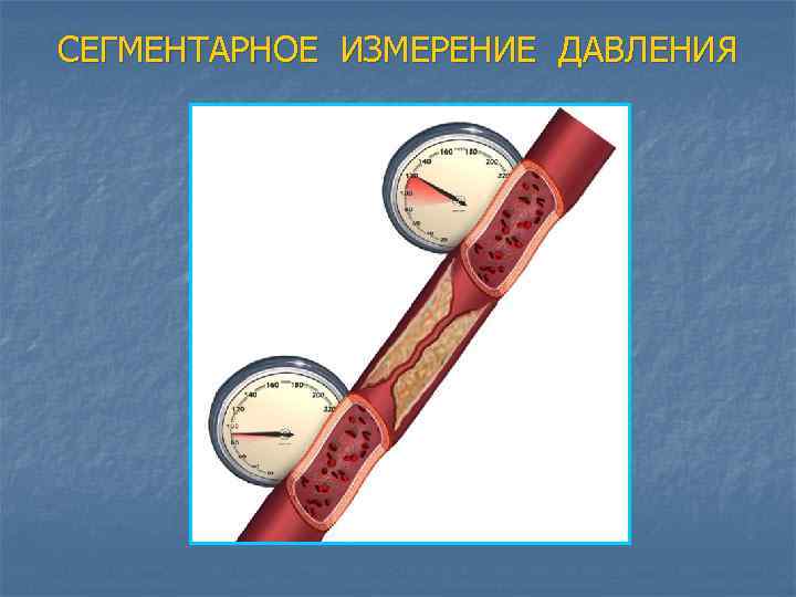 СЕГМЕНТАРНОЕ ИЗМЕРЕНИЕ ДАВЛЕНИЯ 