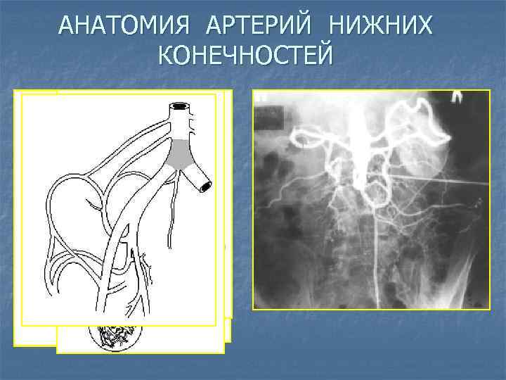 АНАТОМИЯ АРТЕРИЙ НИЖНИХ КОНЕЧНОСТЕЙ 