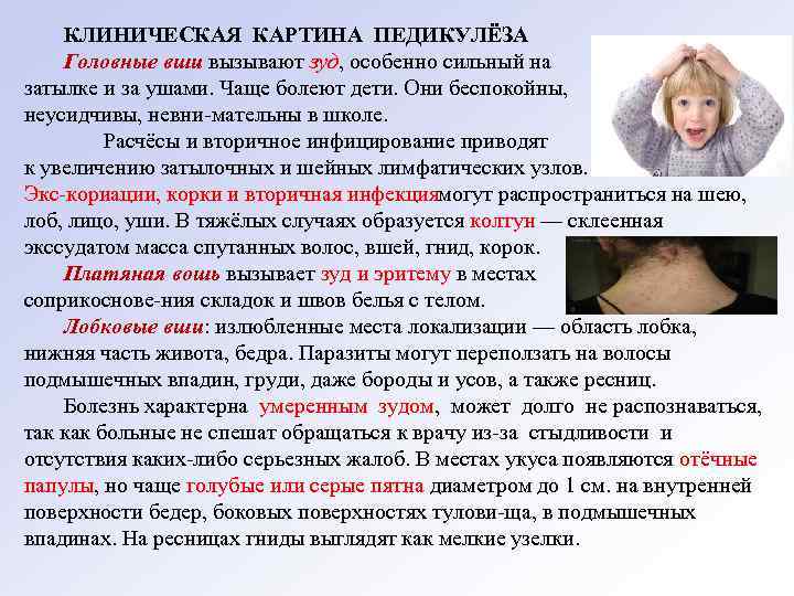 КЛИНИЧЕСКАЯ КАРТИНА ПЕДИКУЛЁЗА Головные вши вызывают зуд, особенно сильный на затылке и за ушами.