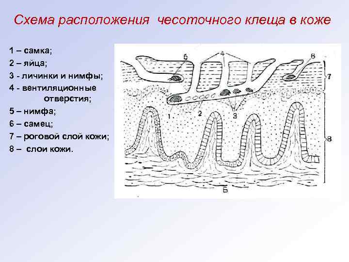 Схема расположения чесоточного клеща в коже 1 – самка; 2 – яйца; 3 -