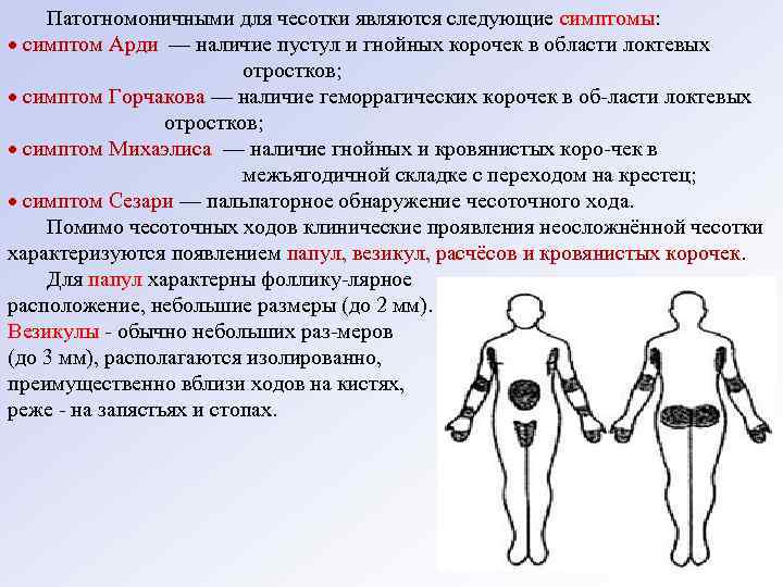 Патогномоничными для чесотки являются следующие симптомы: симптом Арди — наличие пустул и гнойных корочек