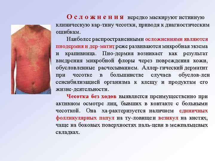 О с л о ж н е н и я нередко маскируют истинную клиническую