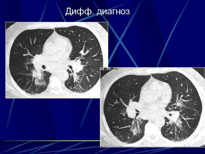 Дифф. диагноз 