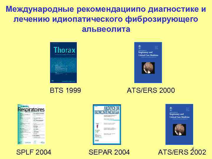 Международные рекомендациипо диагностике и лечению идиопатического фиброзирующего альвеолита BTS 1999 SPLF 2004 ATS/ERS 2000