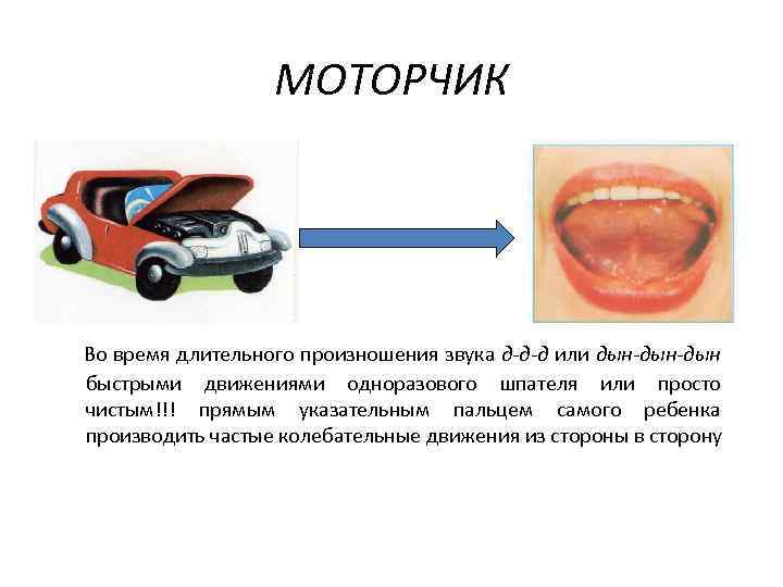 МОТОРЧИК Во время длительного произношения звука д-д-д или дын-дын быстрыми движениями одноразового шпателя или