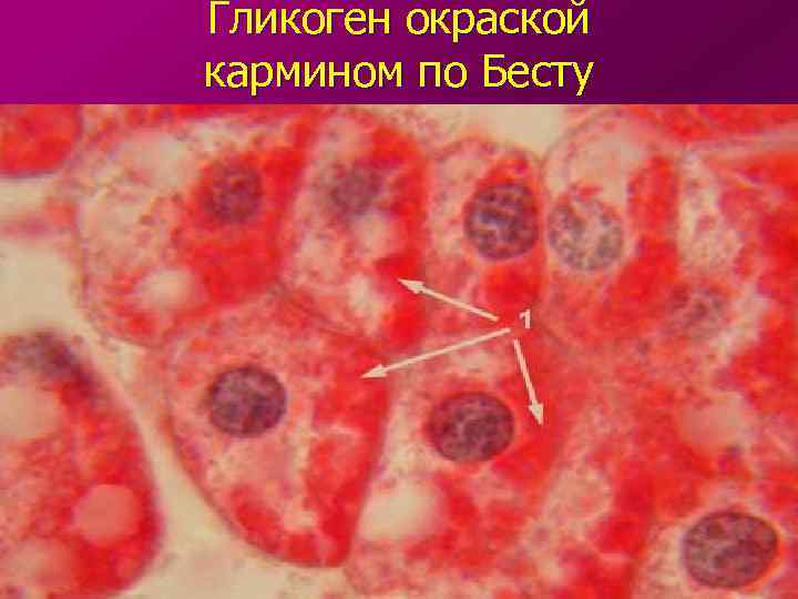 Гликоген окраской кармином по Бесту 