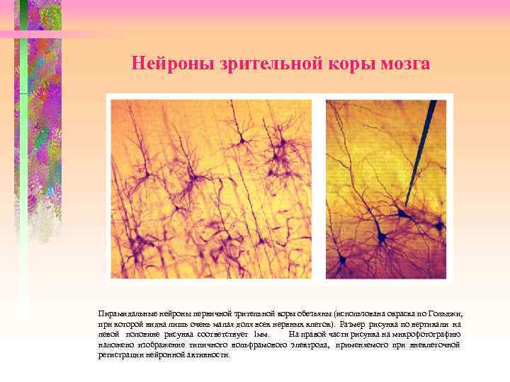  Нейроны зрительной коры мозга Пирамидальные нейроны первичной зрительной коры обезьяны (использована окраска по
