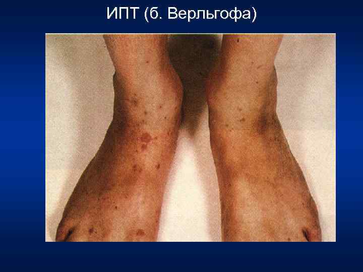 ИПТ (б. Верльгофа) 