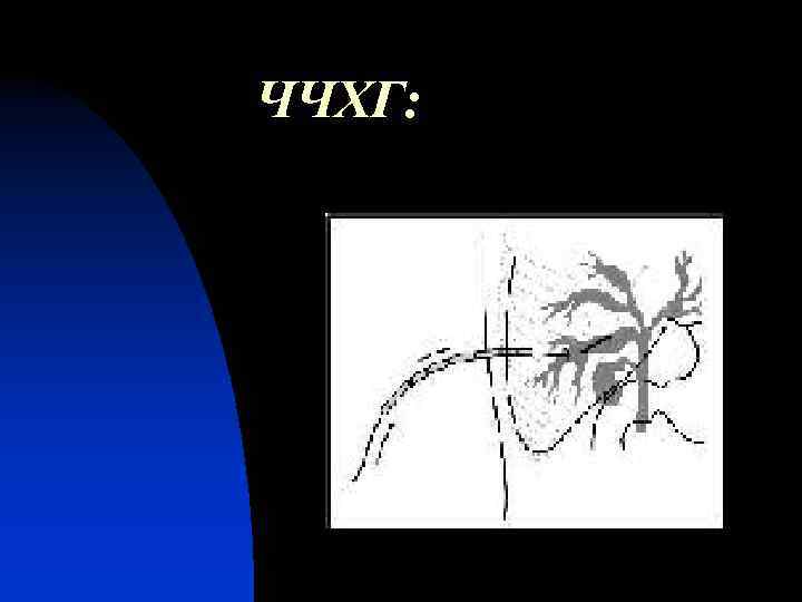 ЧЧХГ: 