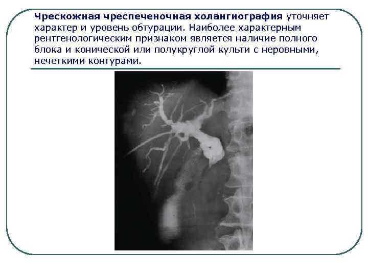 Поджелудочная железа контуры неровные нечеткие