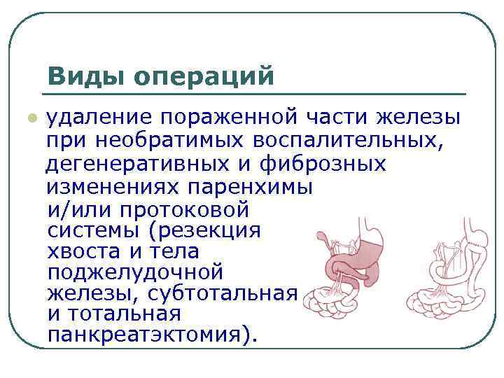 Виды операций l удаление пораженной части железы при необратимых воспалительных, дегенеративных и фиброзных изменениях
