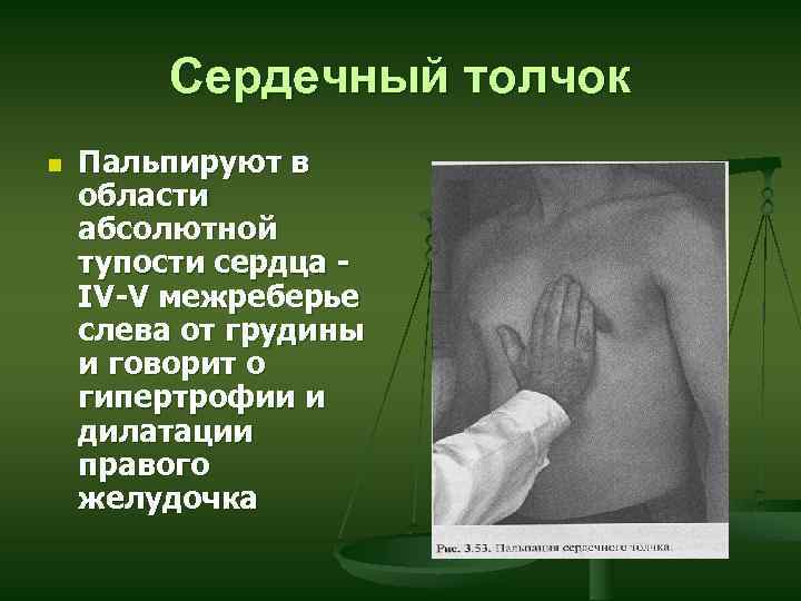 Сердечный толчок n Пальпируют в области абсолютной тупости сердца IV-V межреберье слева от грудины