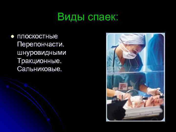 Виды спаек: l плоскостные Перепончасти. шнуровидными Тракционные. Сальниковые. 