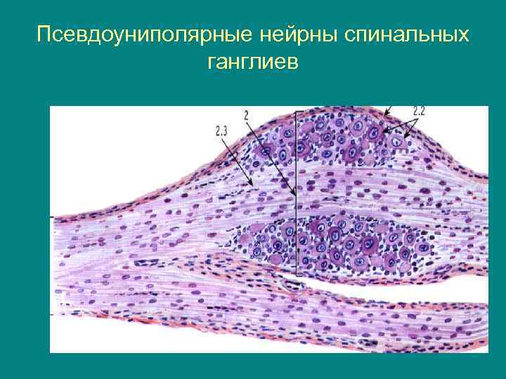 Псевдоуниполярные нейрны спинальных ганглиев 