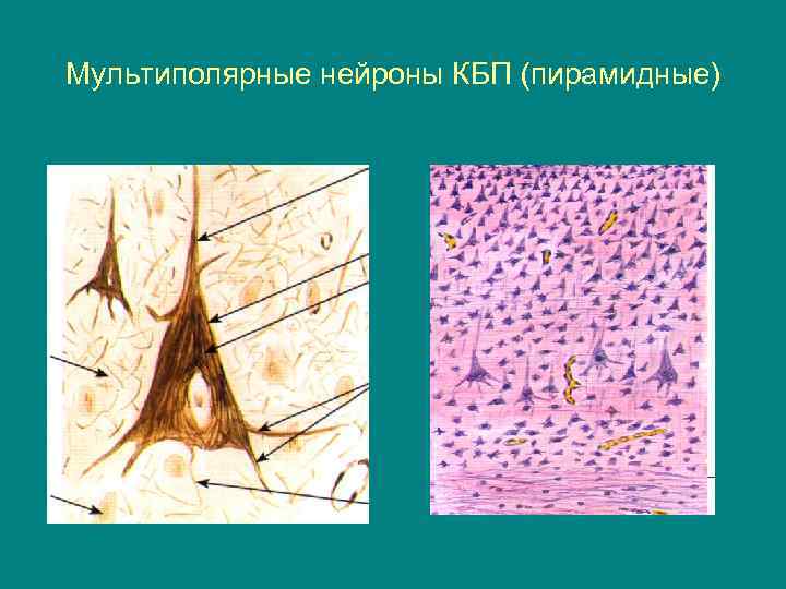 Мультиполярные нейроны КБП (пирамидные) 