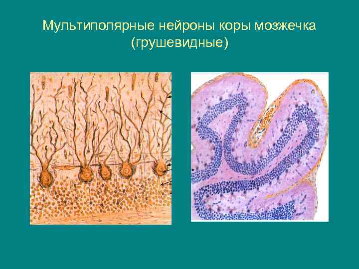 Мультиполярные нейроны коры мозжечка (грушевидные) 