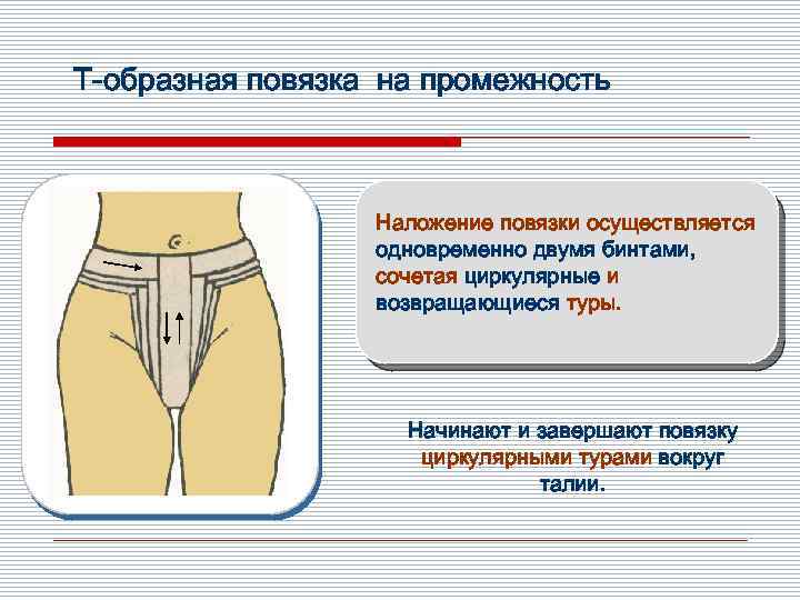 Т-образная повязка на промежность Наложение повязки осуществляется одновременно двумя бинтами, сочетая циркулярные и возвращающиеся