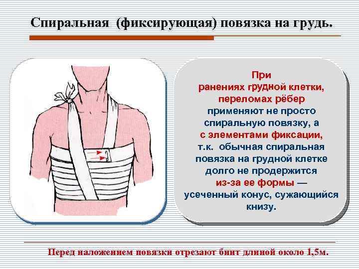 Спиральная (фиксирующая) повязка на грудь. При ранениях грудной клетки, переломах рёбер применяют не просто