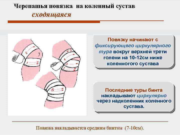 Как долго делать перевязки. Черепашья повязка на коленный сустав. Наложение расходящейся черепашьей повязки. Черепашья сходящаяся повязка алгоритм. Десмургия черепашья повязка.