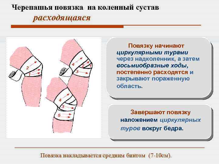 Дополните схему об основных видах бинтов средние