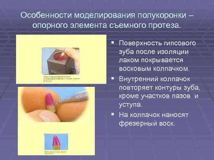 Особенности моделирования полукоронки – опорного элемента съемного протеза. § Поверхность гипсового зуба после изоляции