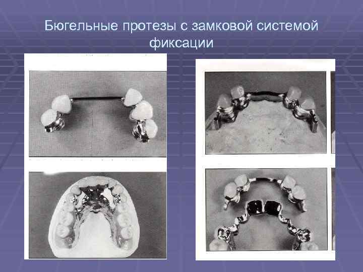 Система фиксации речи