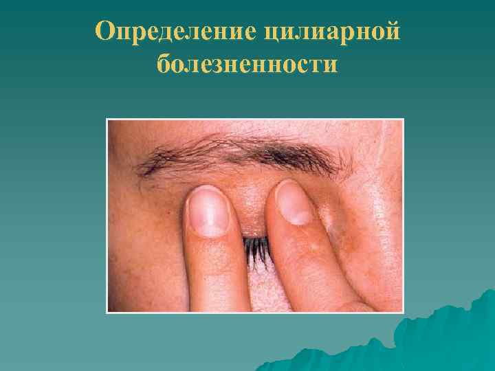 Определение цилиарной болезненности 