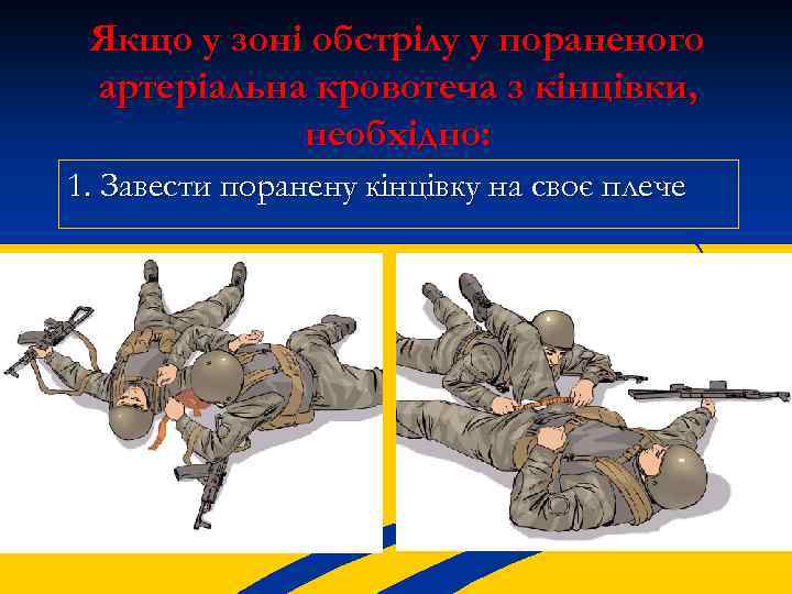 Якщо у зоні обстрілу у пораненого артеріальна кровотеча з кінцівки, необхідно: 1. Завести поранену