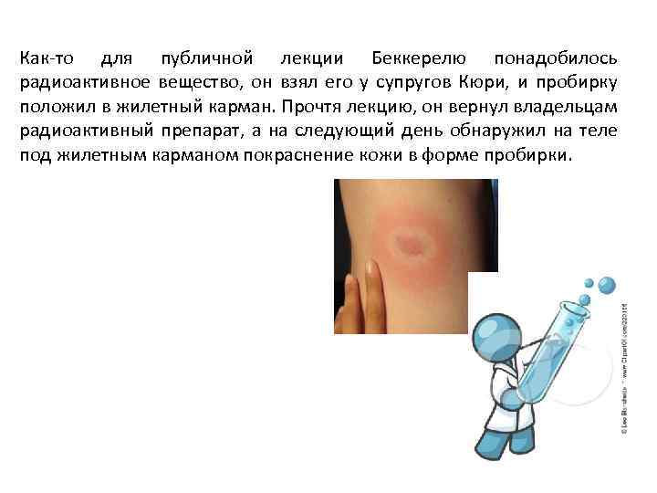 Как-то для публичной лекции Беккерелю понадобилось радиоактивное вещество, он взял его у супругов Кюри,