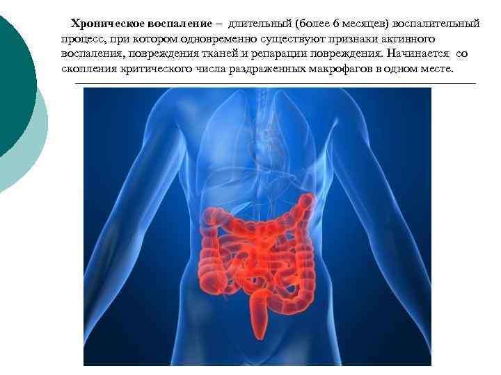 Хроническое воспаление презентация