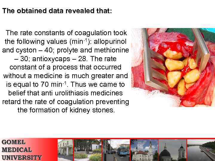 The obtained data revealed that: The rate constants of coagulation took the following values