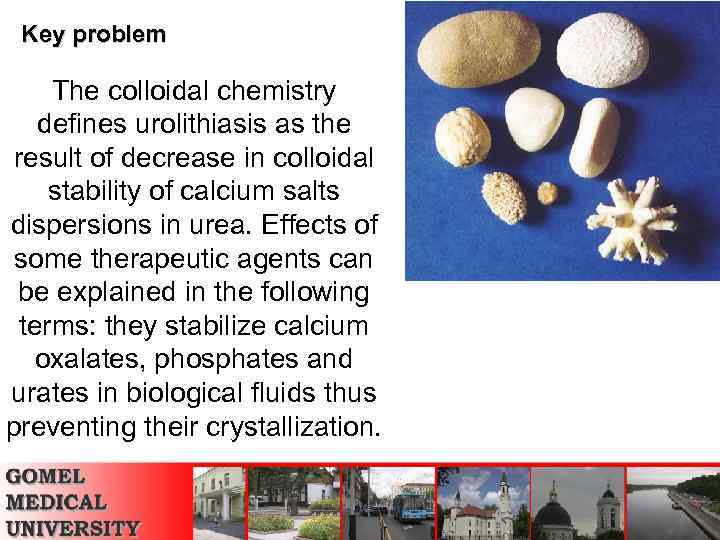 Key problem The colloidal chemistry defines urolithiasis as the result of decrease in colloidal