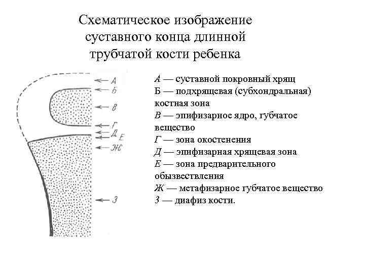 Схематическое изображение суставного конца длинной трубчатой кости ребенка А — суставной покровный хрящ Б