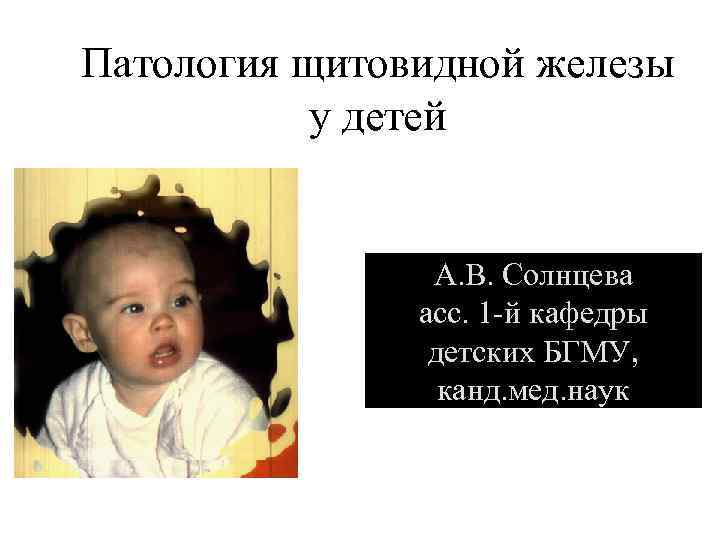 Патология щитовидной железы у детей А. В. Солнцева асс. 1 -й кафедры детских БГМУ,