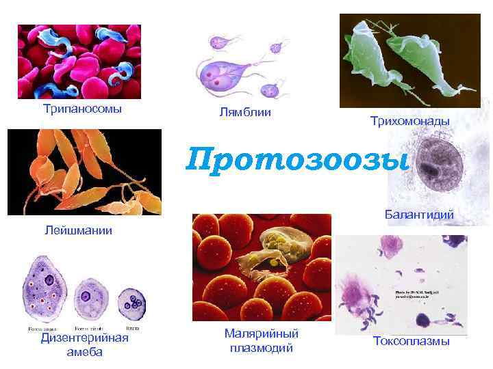 Инфекции вызванные простейшими. Лямблия лейшмания трихомонада. Лейшмания лямблия малярийный плазмодий. Лейшмании, трипаносомы, лямблии, трихомонады. Дизентерийная амеба и малярийный плазмодий.
