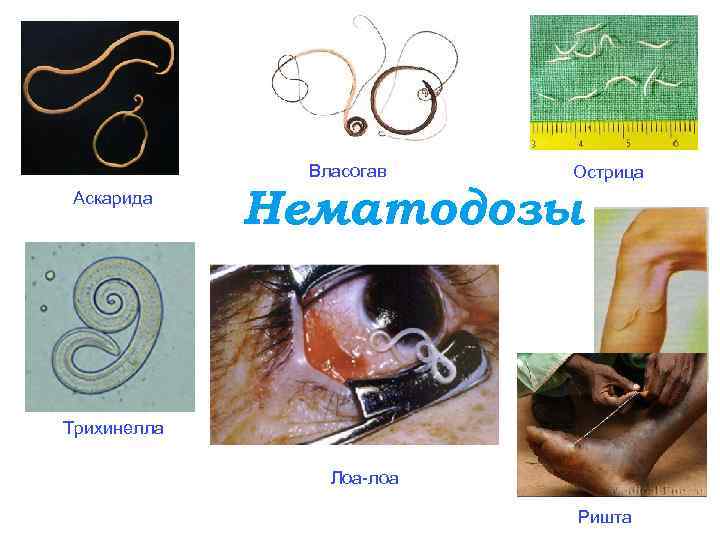 Власогав Аскарида Острица Нематодозы Трихинелла Лоа-лоа Ришта 