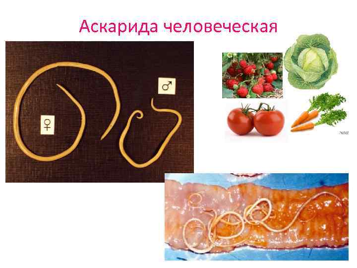 Аскарида человеческая 