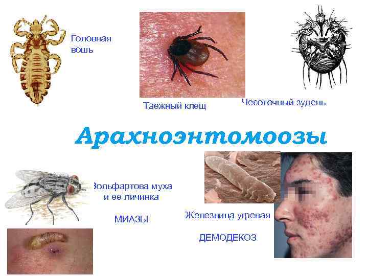 Головная вошь Таежный клещ Чесоточный зудень Арахноэнтомоозы Вольфартова муха и ее личинка МИАЗЫ Железница