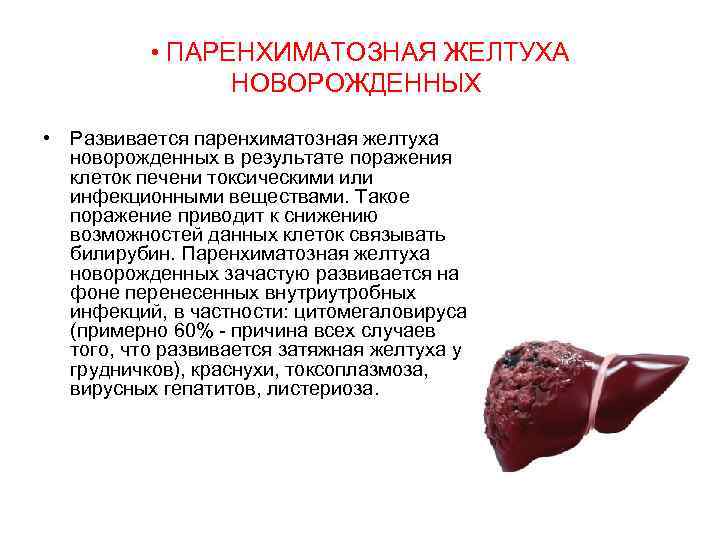  • ПАРЕНХИМАТОЗНАЯ ЖЕЛТУХА НОВОРОЖДЕННЫХ • Развивается паренхиматозная желтуха новорожденных в результате поражения клеток