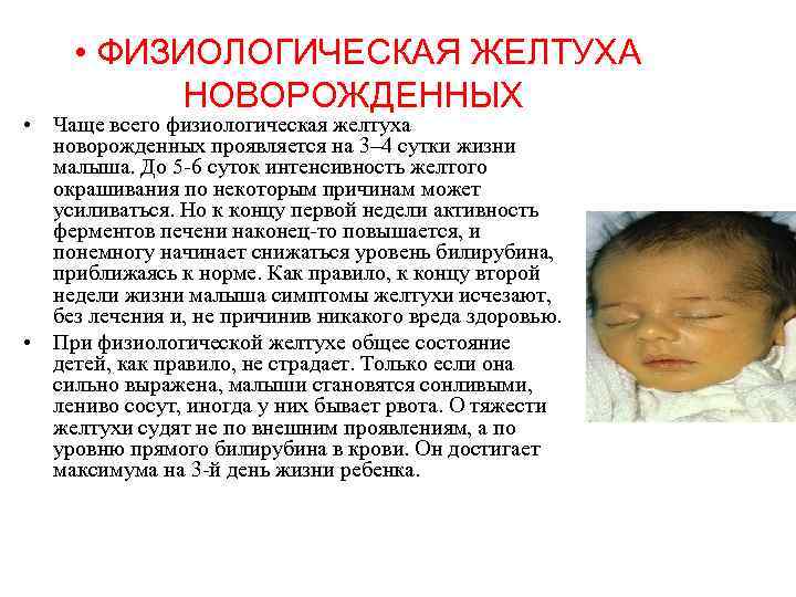  • ФИЗИОЛОГИЧЕСКАЯ ЖЕЛТУХА НОВОРОЖДЕННЫХ • Чаще всего физиологическая желтуха новорожденных проявляется на 3–